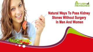 Natural Ways To Pass Kidney Stones Without Surgery In Men And Women