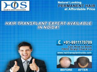 Hair Transplant in Delhi at Discount Price