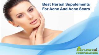 Best Herbal Supplements For Acne And Acne Scars