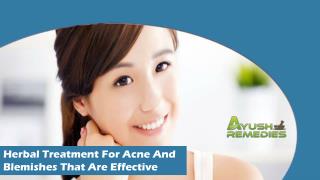 Herbal Treatment For Acne And Blemishes That Are Effective