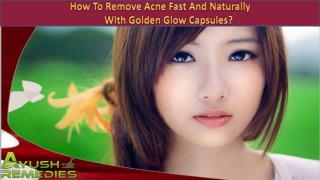 How To Remove Acne Fast And Naturally With Golden Glow Capsules?