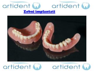 Zobni implantati