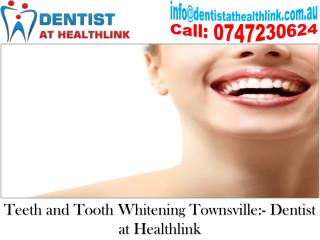 Are You Using The Correct Teeth Whitening Product