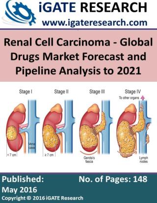 Renal Cell Carcinoma - Global Drugs Market Forecast and Pipeline Analysis to 2021