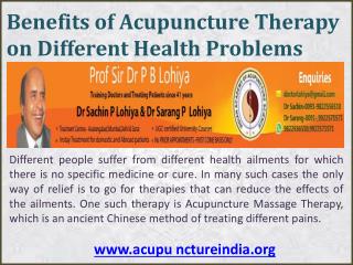 Benefits of Acupuncture