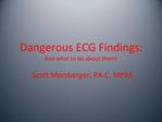 Dangerous ECG Findings: And what to do about them