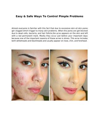 Easy & Safe Ways To Control Pimple Problems