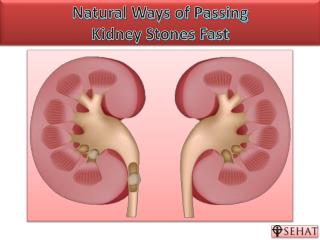 Natural Ways of Passing Kidney Stones | Sehat.com