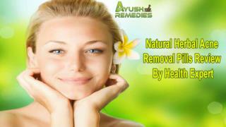 Natural Herbal Acne Removal Pills Review By Health Expert