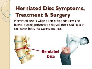 Herniated Disc Symptoms, Treatment & Surgery