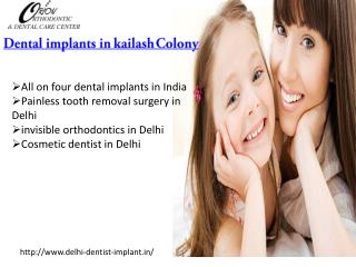 Dental implants in kailash Colony