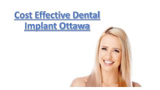 Cost Effective Dental Implant Ottawa