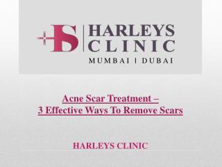 Acne Scar Treatment – 3 Effective Ways To Remove Scars