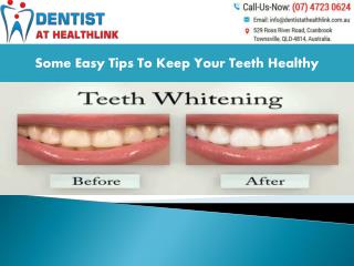 Some Of The Many Solutions For Tooth Whitening Systems