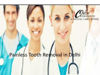 Painless Tooth Removal in Delhi