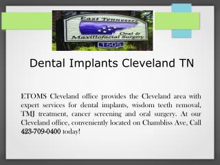 Dental Implants Cleveland TN