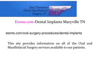 Dental Implants Knoxville TN