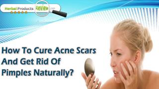 How To Cure Acne Scars And Get Rid Of Pimples Naturally?