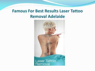 Famous For Best Results Laser Tattoo Removal Adelaide