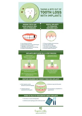 Dental Implants - The smart solution for tooth loss
