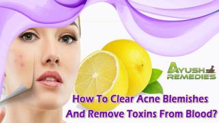 How To Clear Acne Blemishes And Remove Toxins From Blood?