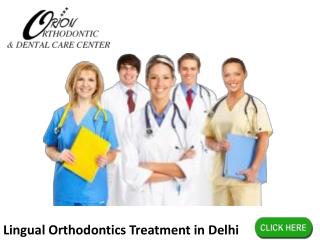 Lingual Orthodontics Treatment in Delhi