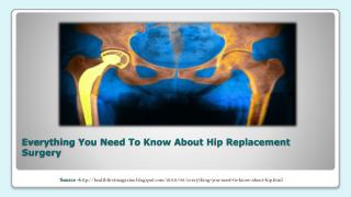 Everything You Need To Know About Hip Replacement Surgery