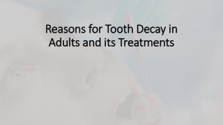Reasons for tooth decay