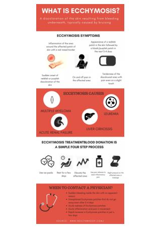 WHAT IS ECCHYMOSIS?