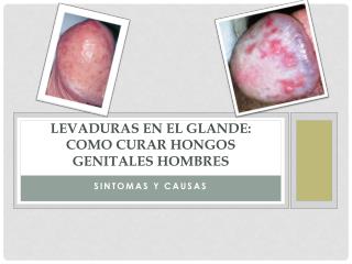 Levaduras en el Glande: Como Curar Hongos Genitales Hombres Sintomas y Causas