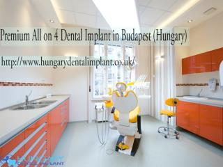Premium All on 4 Dental Implant Budapest (Hungary)