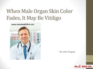 When Male Organ Skin Color Fades, It May Be Vitiligo