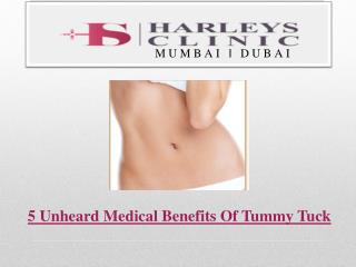 5 Unheard Medical Benefits Of Tummy Tuck