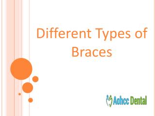 Different Types of Braces