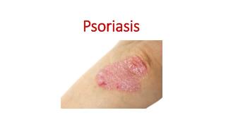 All About Psoriasis