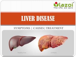 Liver Disease: Symptoms, causes, treatment, prevention and more