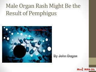 Male Organ Rash Might Be the Result of Pemphigus