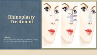 Rhinoplasty Treatment