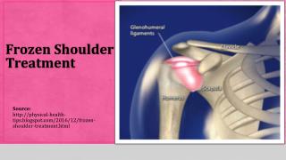 Frozen Shoulder Treatment