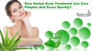 How Herbal Acne Treatment Can Cure Pimples And Scars Quickly?