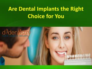 Are Dental Implants the Right Choice for You