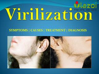Virilization: A common female health condition