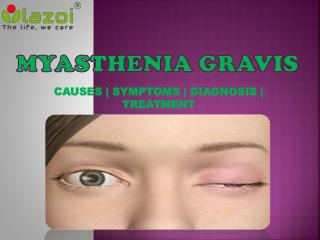 Myasthenia Gravis: Symptoms, Causes, diagnosis and treatment.