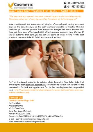 Laser Acne Scar Treatment in Delhi – AAYNA Clinic