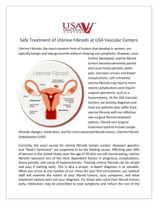 Safe Treatment of Uterine Fibroids at USA Vascular Centers