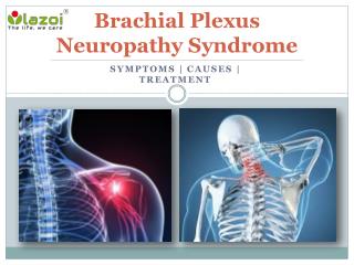 Brachial Plexus Neuropathy Syndrome : Causes, Symptoms, Daignosis and Treatment