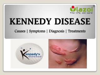 Kennedy disease: symptoms, causes, diagnosis and treatment.