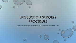 Liposuctions Surgery Procedure