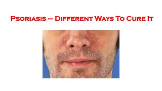 Psoriasis – different ways to cure it