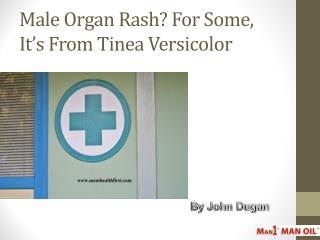 Male Organ Rash? For Some, It’s From Tinea Versicolor